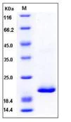 SDS-PAGE - Recombinant Mouse RBP4 protein (His tag) (AB276783)