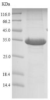 SDS-PAGE - Recombinant Mouse REG1 protein (His tag) (AB226312)