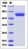 SDS-PAGE - Recombinant Mouse RISC protein (His tag) (AB277011)