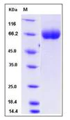 SDS-PAGE - Recombinant Mouse Robo4 protein (His tag) (AB276973)
