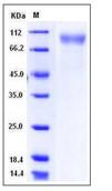 SDS-PAGE - Recombinant Mouse RP105 protein (His tag) (AB276859)