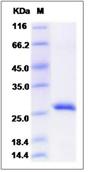 SDS-PAGE - Recombinant Mouse RPE protein (His tag) (AB276953)