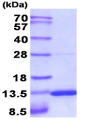 SDS-PAGE - Recombinant Mouse S100A10 protein (His tag C-Terminus) (AB208308)