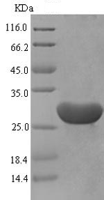 SDS-PAGE - Recombinant Mouse SAA1 protein (Tagged) (AB235967), expandable thumbnail