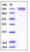 SDS-PAGE - Recombinant Mouse Scavenging Receptor SR-BI protein (Fc Chimera His Tag) (AB276814)