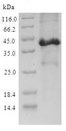 SDS-PAGE - Recombinant Mouse SCGB3A2 protein (Tagged) (AB239571)