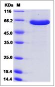 SDS-PAGE - Recombinant Mouse Semaphorin 3A protein (His tag) (AB276887)
