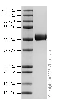 SDS-PAGE - Recombinant Mouse SERPINA1A Protein (AB313359)