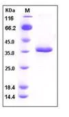 SDS-PAGE - Recombinant Mouse SFRP2 protein (His tag) (AB276748)