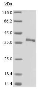 SDS-PAGE - Recombinant Mouse SFRP5 protein (His tag) (AB235970)