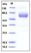 SDS-PAGE - Recombinant Mouse SIGIRR protein (Fc Chimera His Tag) (AB276770)