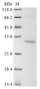 SDS-PAGE - Recombinant mouse SLC25A18 protein (His tag) (AB314517)