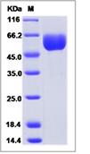 SDS-PAGE - Recombinant Mouse SMPDL3A protein (His tag) (AB277014)