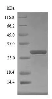 SDS-PAGE - Recombinant Mouse SOCS1 protein (Tagged) (AB236163)