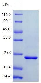 SDS-PAGE - Recombinant mouse Sonic Hedgehog protein (Active) (AB243237)