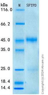 SDS-PAGE - Recombinant Mouse SP-D Protein Standard (His tag) (AB316638), expandable thumbnail