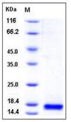 SDS-PAGE - Recombinant Mouse sPLA2-IIE protein (His tag) (AB276900), expandable thumbnail