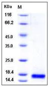 SDS-PAGE - Recombinant Mouse sPLA2-IIE protein (His tag) (AB276900)