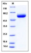 SDS-PAGE - Recombinant Mouse ST6GAL1 protein (His tag) (AB276920)