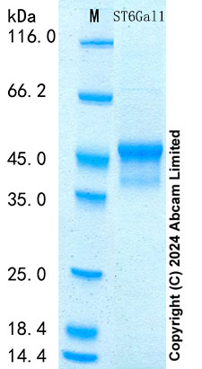 SDS-PAGE - Recombinant Mouse ST6Gal1 Protein Standard (His tag) (AB316715), expandable thumbnail