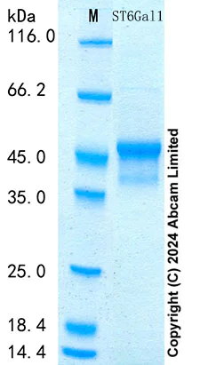 SDS-PAGE - Recombinant Mouse ST6Gal1 Protein Standard (His tag) (AB316715)