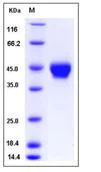 SDS-PAGE - Recombinant Mouse ST6GALNAC2 protein (AB276927)