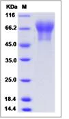 SDS-PAGE - Recombinant Mouse SynCAM/CADM1 protein (His tag) (AB276866)