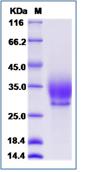 SDS-PAGE - Recombinant Mouse Syndecan 2/HSPG protein (His tag) (AB276969), expandable thumbnail
