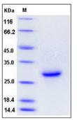 SDS-PAGE - Recombinant Mouse Syndecan 4 protein (His tag) (AB276917)