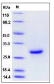SDS-PAGE - Recombinant Mouse Syndecan 4 protein (His tag) (AB276917)