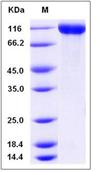 SDS-PAGE - Recombinant Mouse TAG1/TAX1 protein (His tag) (AB276982), expandable thumbnail