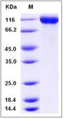 SDS-PAGE - Recombinant Mouse TAG1/TAX1 protein (His tag) (AB276982)