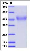 SDS-PAGE - Recombinant mouse TCblR protein (His tag) (AB276989)