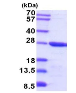 SDS-PAGE - Recombinant Mouse TCTP protein (His tag N-Terminus) (AB202247)