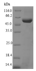 SDS-PAGE - Recombinant Mouse Telomerase reverse transcriptase protein (Tagged) (AB226420), expandable thumbnail