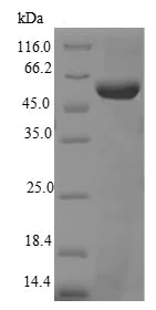 SDS-PAGE - Recombinant Mouse Telomerase reverse transcriptase protein (Tagged) (AB226420)