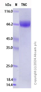 SDS-PAGE - Recombinant Mouse Tenascin C Protein Standard (His tag) (AB316523)