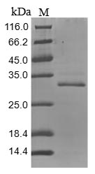 SDS-PAGE - Recombinant Mouse Tenascin protein (AB267838), expandable thumbnail