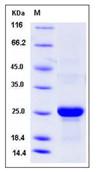 SDS-PAGE - Recombinant Mouse Tetranectin protein (His tag) (AB276907)