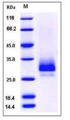 SDS-PAGE - Recombinant Mouse TFPI2 protein (His tag) (AB276961), expandable thumbnail