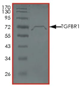 SDS-PAGE - Recombinant mouse TGF beta Receptor I protein (Active) (AB269040)