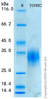 SDS-PAGE - Recombinant Mouse TGF beta Receptor II Protein Standard (His tag) (AB316468)