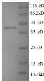 SDS-PAGE - Recombinant Mouse Thrombospondin 1 protein (His tag) (AB236329)