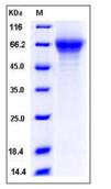 SDS-PAGE - Recombinant Mouse THSD1 protein (His tag) (AB276836)