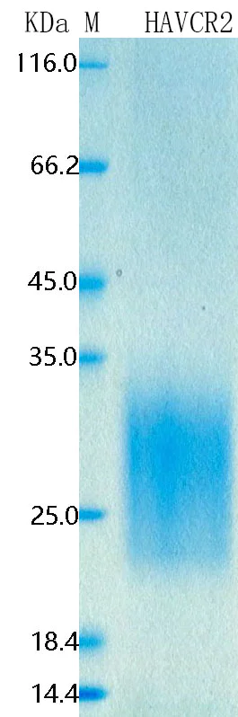 SDS-PAGE - Recombinant Mouse TIM-3 Protein Standard (His tag) (AB316525)