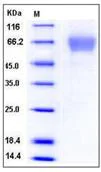 SDS-PAGE - Recombinant Mouse TIM 4 protein (His tag) (AB276831)