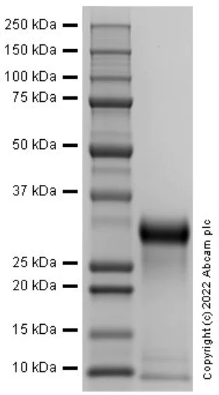 SDS-PAGE - Recombinant Mouse TIMP1 Protein (Active) (AB291058)