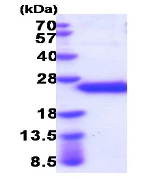 SDS-PAGE - Recombinant Mouse TIMP1 protein (His tag C-Terminus) (AB206786)