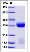 SDS-PAGE - Recombinant Mouse Tissue kallikrein protein (His tag) (AB276936)
