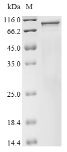 SDS-PAGE - Recombinant mouse TMC1 protein (His tag) (AB314516)